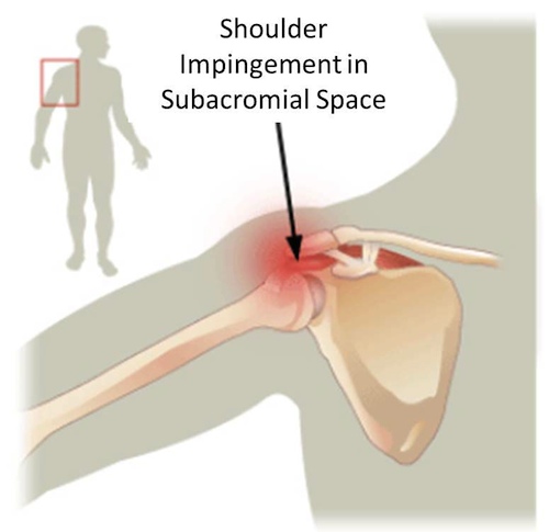 shoulder exercises prevent shoulder injuries