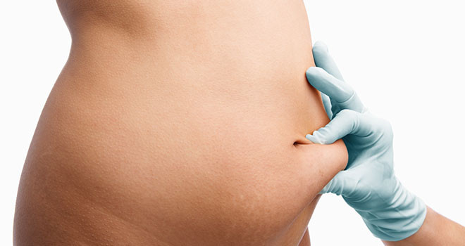 tummy tuck stomach belly 